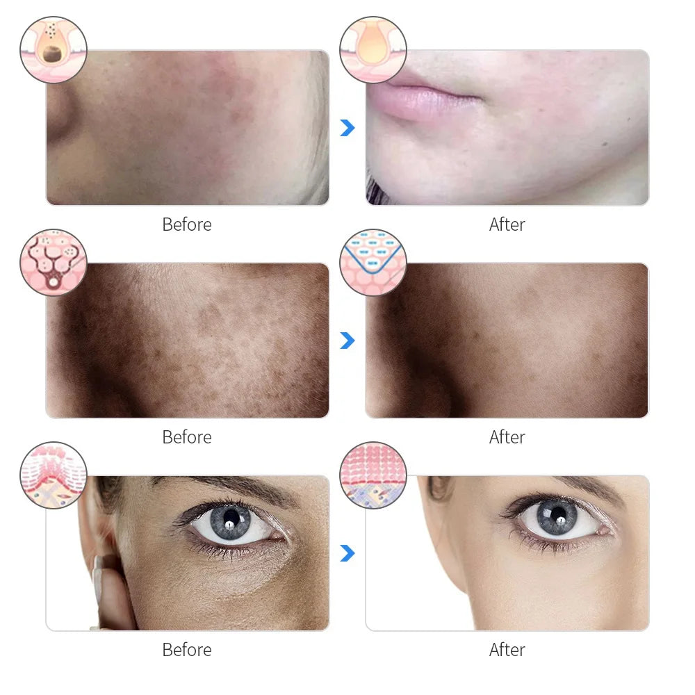 Advanced 7-Color LED Therapy Mask view 5