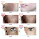 Advanced 7-Color LED Therapy Mask view 5