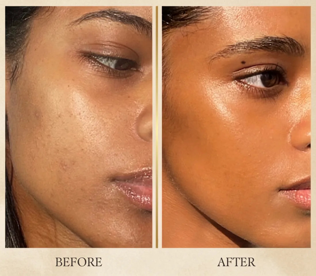Skin before and after consistent Reluma Mask use